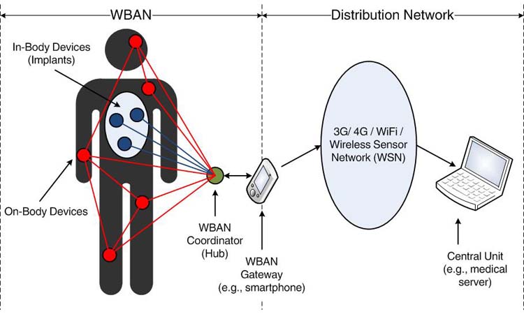 Processo di applicazione della rete di sensori wireless in campo medico