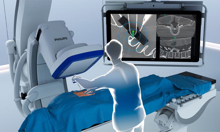 Cas d'utilisation de la reconnaissance vidéo dans les soins de santé